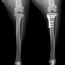 TPLO Caudocranial X-ray