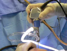 Arthroscopic Surgery