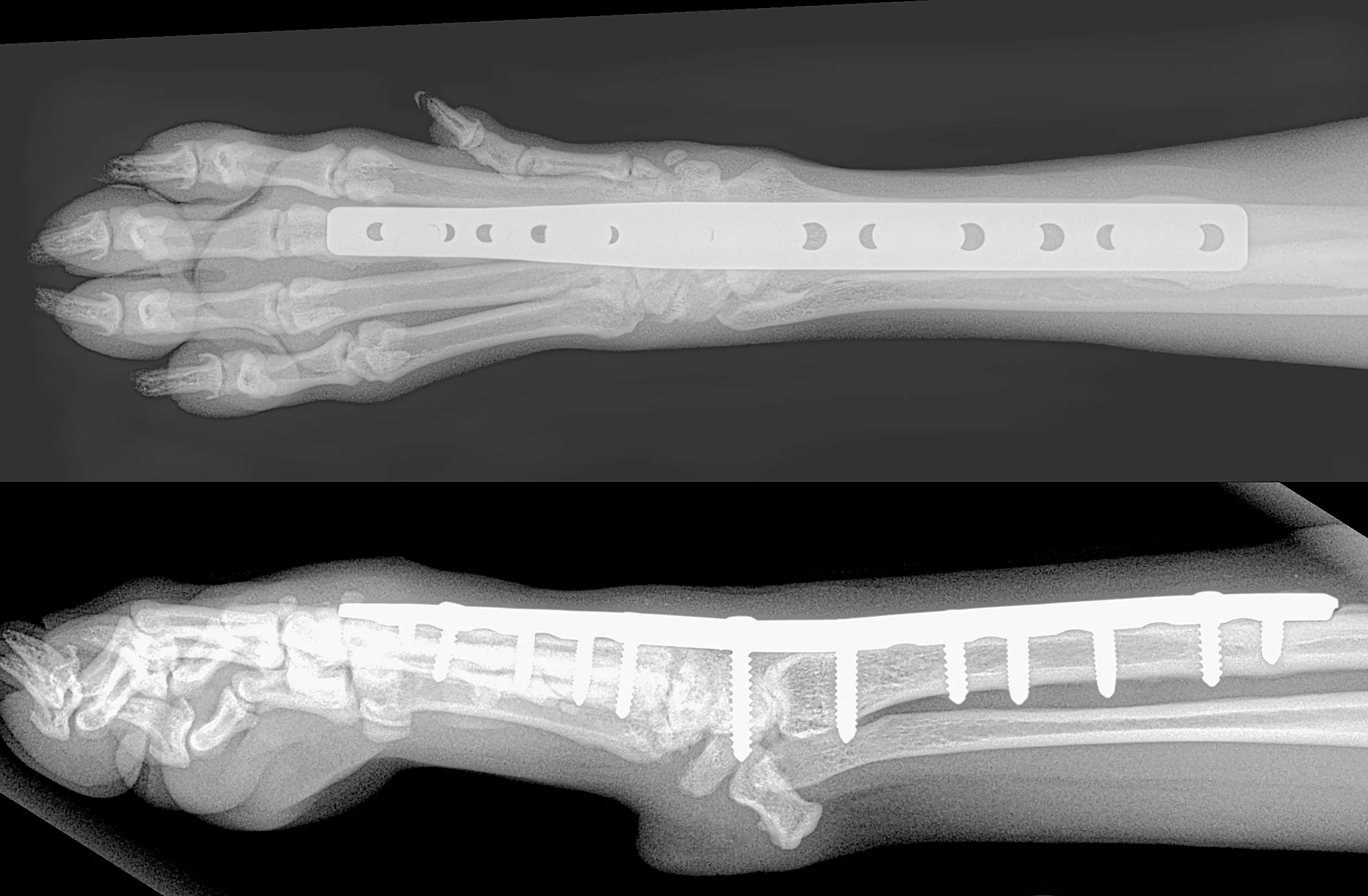 Orthopaedic radiographs showing a repaired fracture and surgical fixation