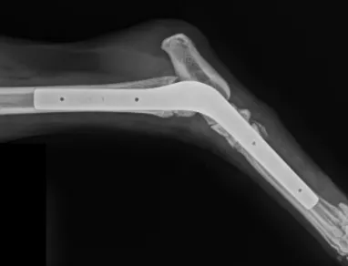 Orthopaedic radiographs showing tarsal arthrodesis with surgical fixation and bone healing