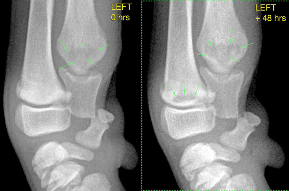 Hypertrophic osteodystrophy 48hrs Left carpus