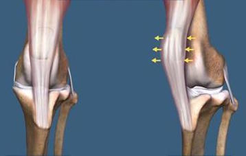 Diagrammatic representation of medial patellar luxation